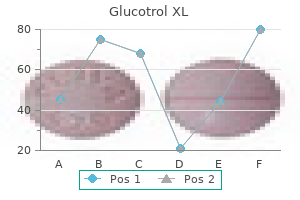 discount 10mg glucotrol xl overnight delivery