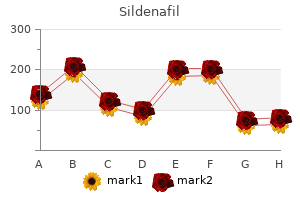 sildenafil 25 mg fast delivery