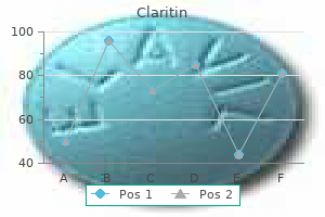 generic claritin 10 mg with amex