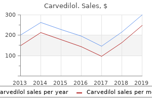 generic 12.5 mg carvedilol fast delivery